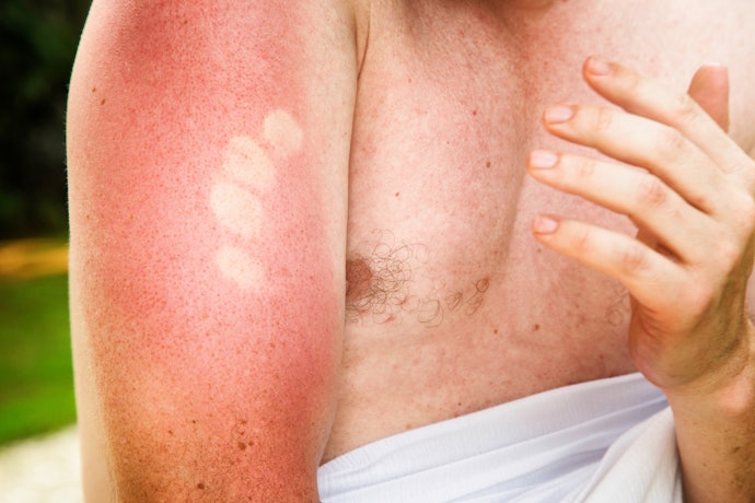 Avoid Sunburns With UPF Fabric